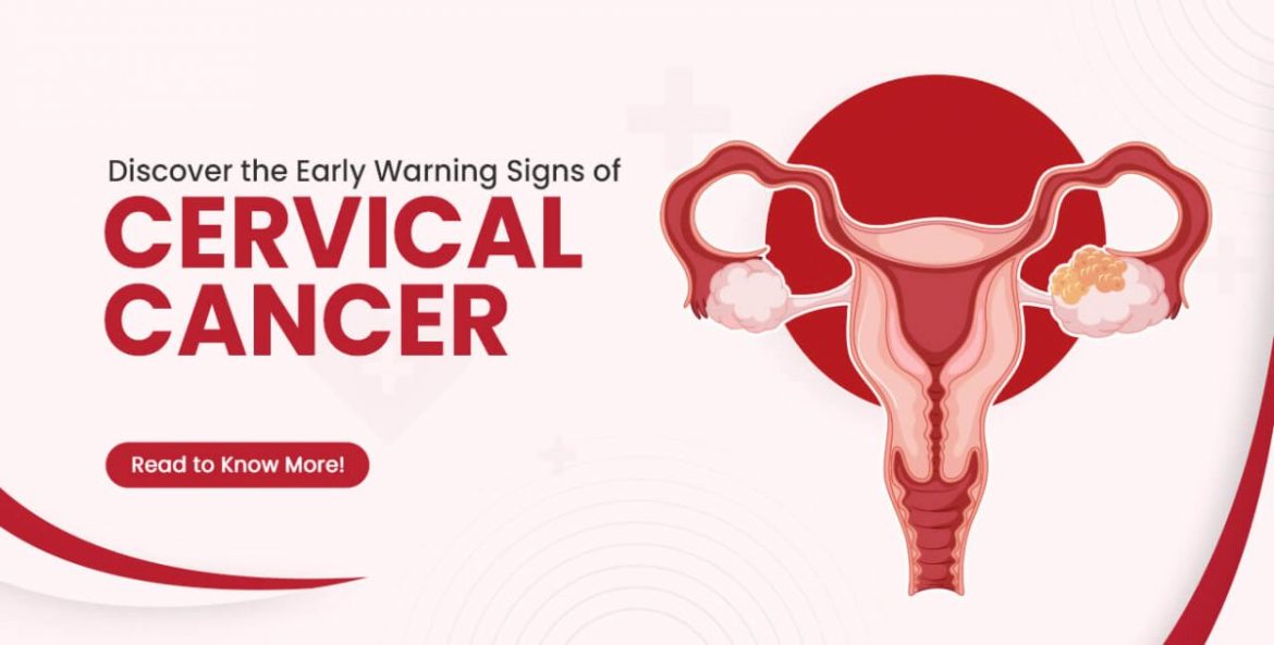Cervical cancer